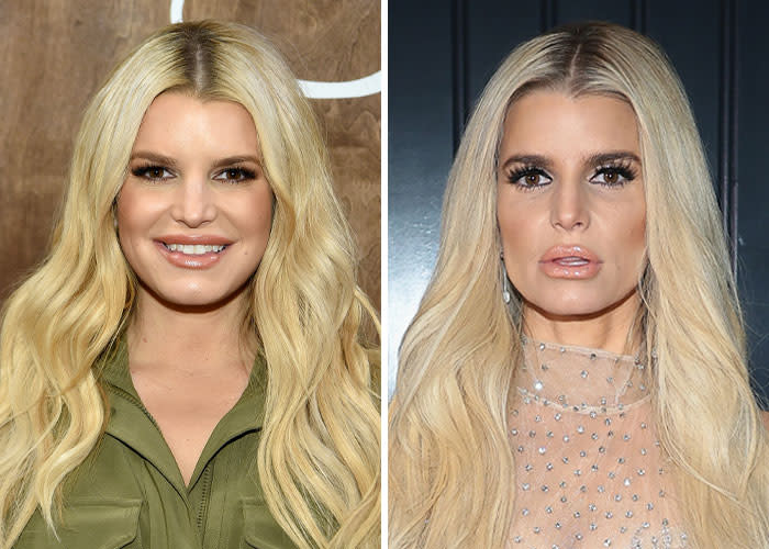 Ozempic-kasvot ennen ja jälkeen - Jessica Simpson Celebrates
