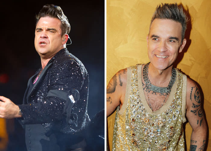 Ozempic-kasvot ennen ja jälkeen - Robbie Williams